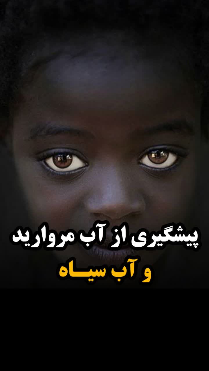 پیشگیری از آب مروارید